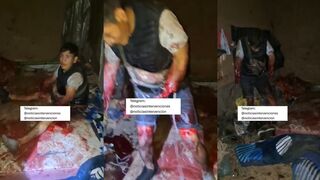 (REPOST)A man dynamited his pregnant partner and lost both arms.