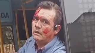 Peru: Bus Driver Seriously Injured Following Armed Attack