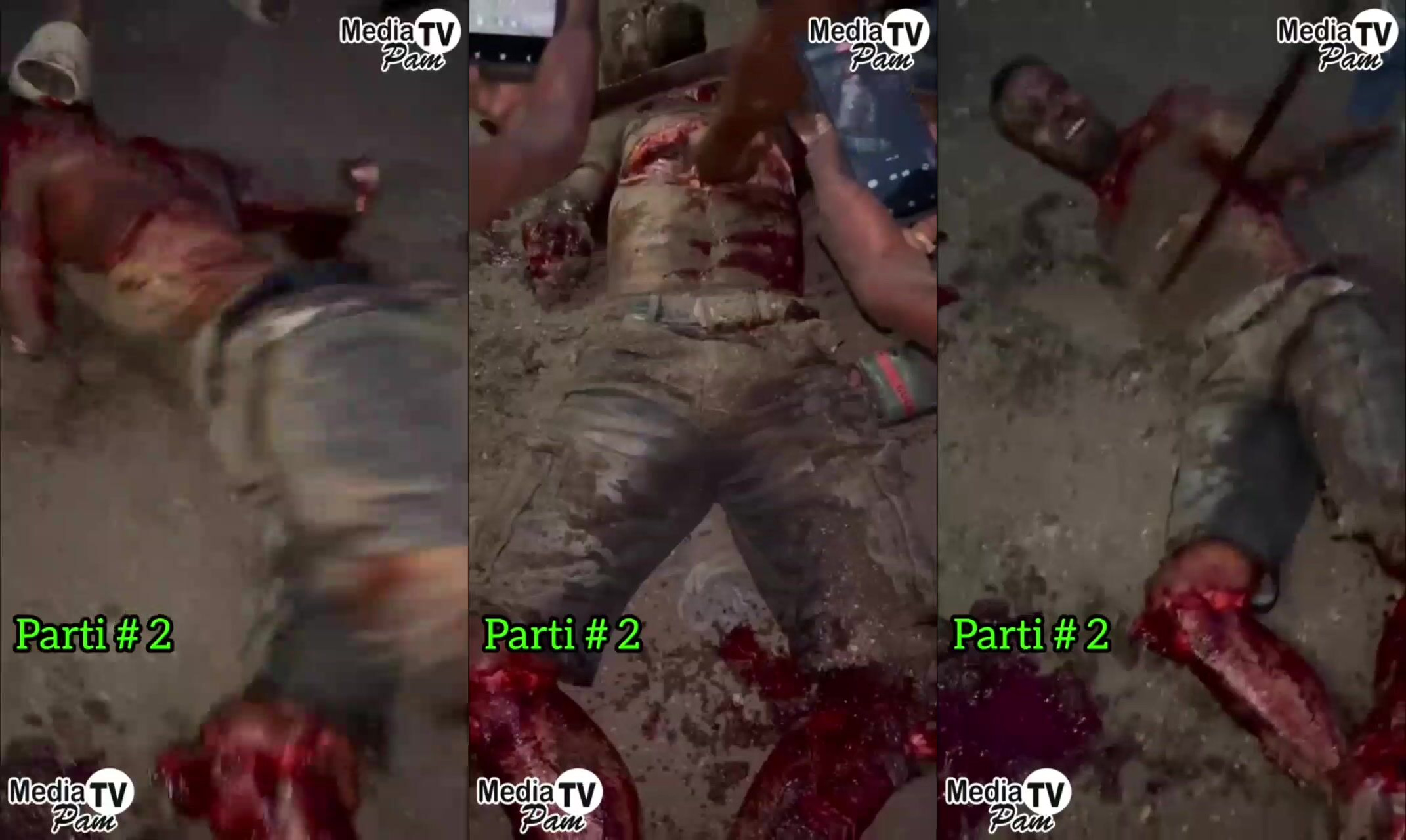 Part 2 Of Haitian Man Getting Mutilated And Dismembered Alive