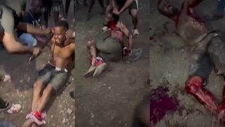 {Full Version} Haitian Man Gets Mutilated And Dismembered Alive