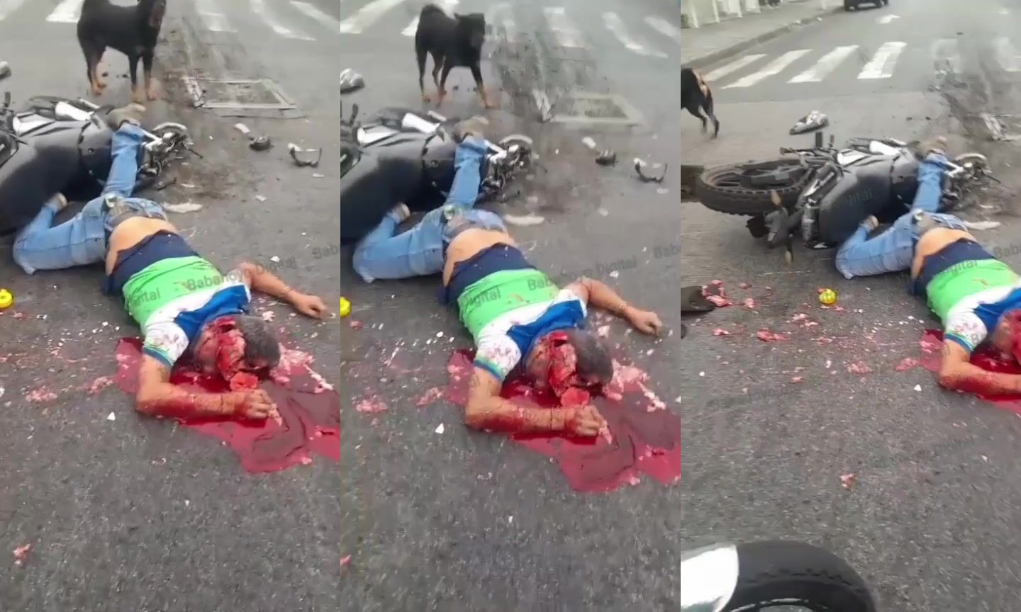 Motorcycle Accident Left Man With Head Shattered