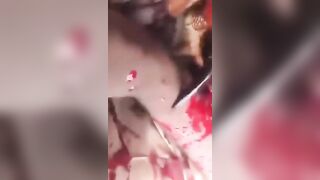 RSF Fighter Shot While Recording A Video