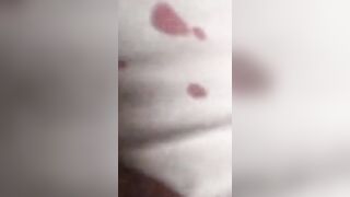 RSF Fighter Shot While Recording A Video