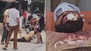 Man Violently Attacked, Thugs Urinate On Him
