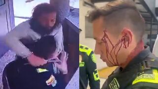 Hairy Sicko Attacks Police Officer With A Knife Before Being Shot