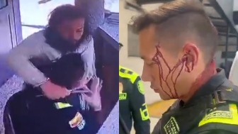 Hairy Sicko Attacks Police Officer With A Knife Before Being Shot