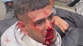 Motorcyclist Caught Snatching Phones In Bogota