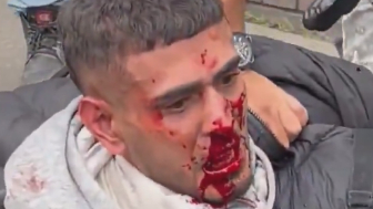 Motorcyclist Caught Snatching Phones In Bogota