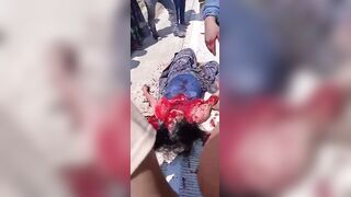Woman Dies After Falling From Moving Truck Bed In Guatemala