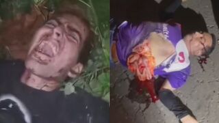 One Killed With Exposed Entrails, Another Injured in Motorcycle Accident Aftermath