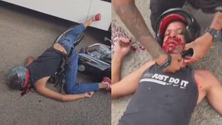 Last Seconds Of Motorcyclist In Caracas