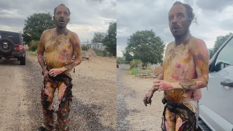 Texas:  Man suffers severe burns following basement gas explosion