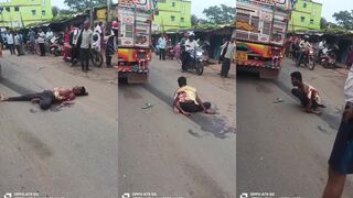 Arm destroyed when ran over by bus