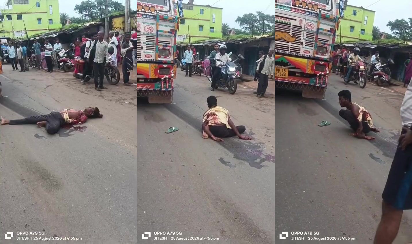 Arm destroyed when ran over by bus