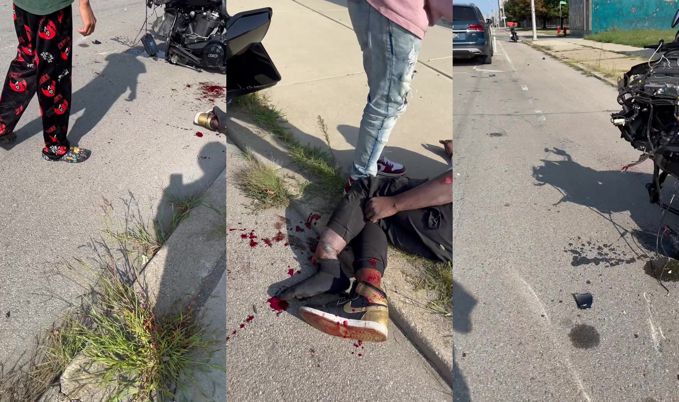 Riding harley breaks leg