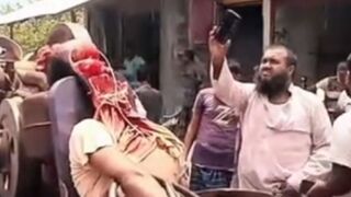 Horrible accident leaves man unrecognizable