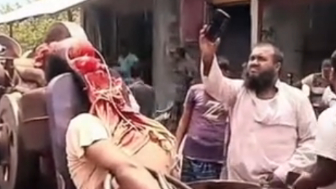 Horrible accident leaves man unrecognizable