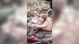 SICK: Atrocities Of Civil War In Myanmar