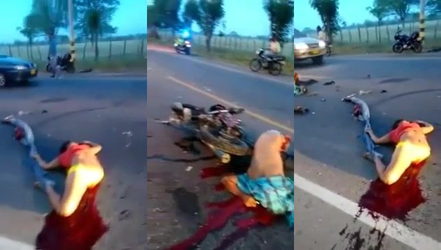 Bike Accident