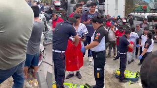 Emergency workers recover severed arm after car accident