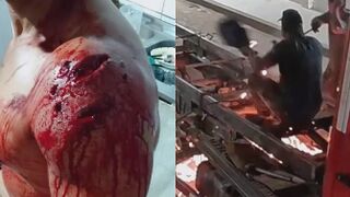 Man Seriously Wounded During Attempted Murder In Brazil