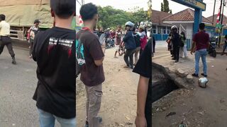 Womans leg shredded by truck