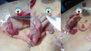 Woman finds human hand in fish stomach