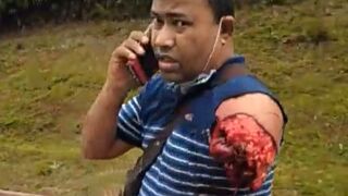 Classic: Man Walks and Talks on Phone Like It’s Just a Scratch