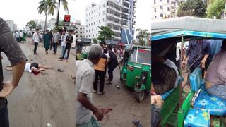 Man snaps his femur after road accident in Bangladesh