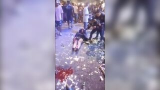 A Woman Was Shot In Her Face