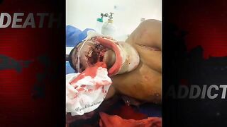 Guerrilla Member Was Tortured And Murdered In Bogota