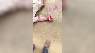 Prostute Was Beaten And Stabbed By Gang Member
