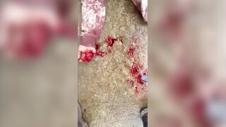 Prostute Was Beaten And Stabbed By Gang Member