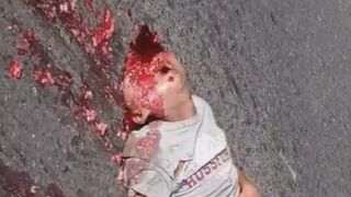 Man Lost Life, Brain In Motorcycle Accident In Guatemala