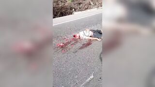 Man Lost Life, Brain In Motorcycle Accident In Guatemala
