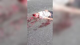 Man Lost Life, Brain In Motorcycle Accident In Guatemala