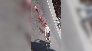 Man Lost Life, Brain In Motorcycle Accident In Guatemala