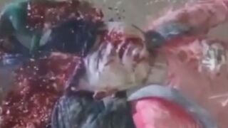 He Crushed Him Again: Man Ran Over By Ther Truck TWICE