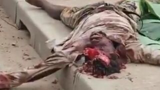 Motorcyclist Caused A Serious Accident Before Dying