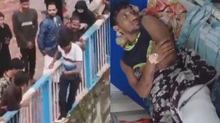 Dude Breaks Both Legs While Making A Reel