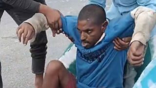 Wrong Way To Treat Accident Victim With Open Fracture