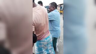 Wrong Way To Treat Accident Victim With Open Fracture