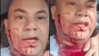Taxi driver stabbed by thief