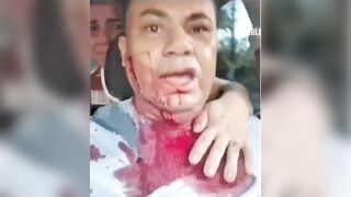 Taxi driver stabbed by thief