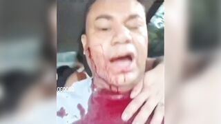 Taxi driver stabbed by thief