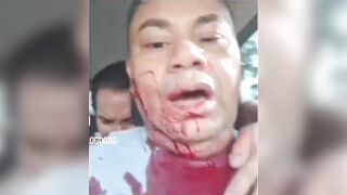 Taxi driver stabbed by thief
