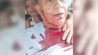 Taxi driver stabbed by thief