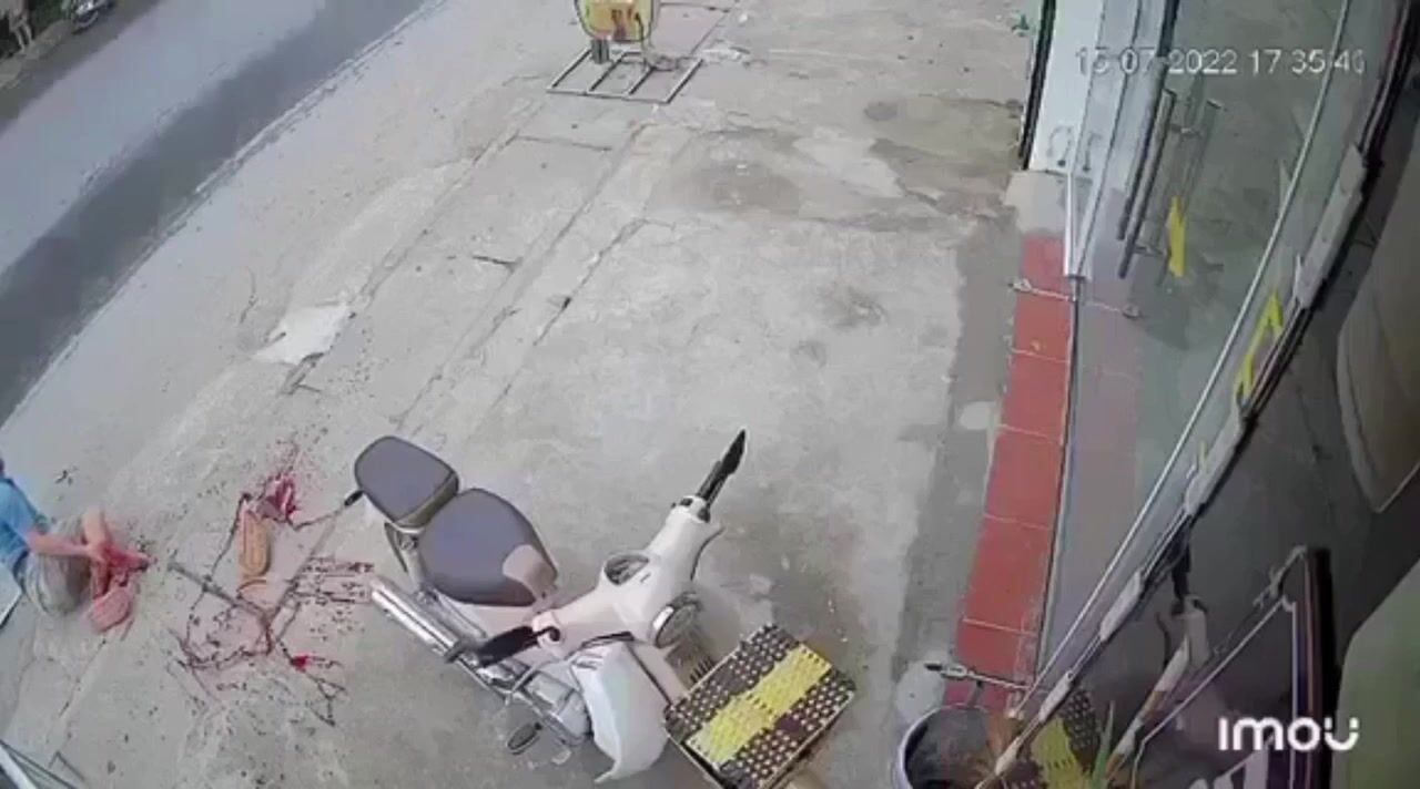 CLASSIC Man Walks Calmly And Someone Chops Off His Foot With A Machete.