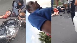 CLASSIC Motorcycle Accident Rips Open Woman's Leg, Exposing Her Femur.