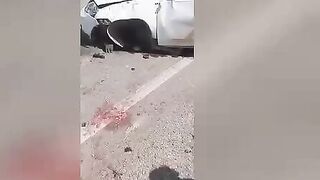 Man Driver Lost His Brain In A Car Accident